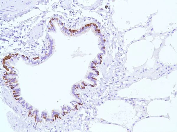 Immunohistochemistry (Formalin/PFA-fixed paraffin-embedded sections) - Anti-Cytokeratin 5 antibody [SP27] (AB64081)