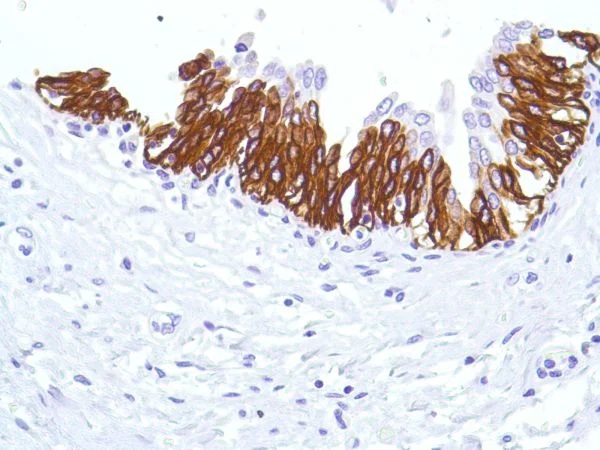 Immunohistochemistry (Formalin/PFA-fixed paraffin-embedded sections) - Anti-Cytokeratin 5 antibody [SP27] (AB64081)