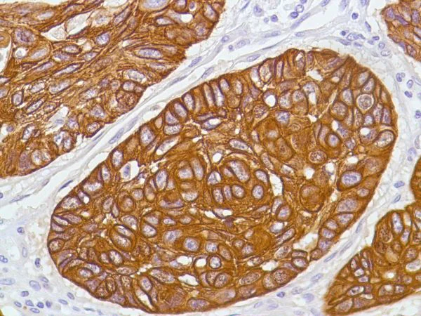 Immunohistochemistry (Formalin/PFA-fixed paraffin-embedded sections) - Anti-Cytokeratin 5 antibody [SP27] (AB64081)