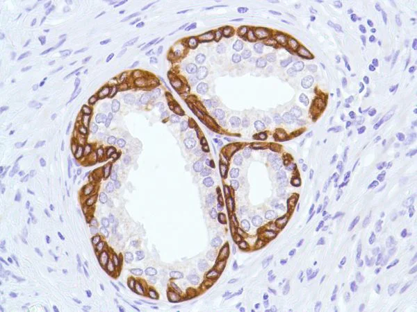 Immunohistochemistry (Formalin/PFA-fixed paraffin-embedded sections) - Anti-Cytokeratin 5 antibody [SP27] (AB64081)