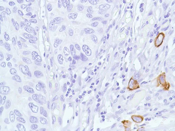 Immunohistochemistry (Formalin/PFA-fixed paraffin-embedded sections) - Anti-Cytokeratin 5 antibody [SP27] (AB64081)