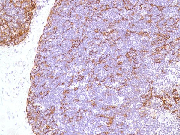 Immunohistochemistry (Formalin/PFA-fixed paraffin-embedded sections) - Anti-Cytokeratin 5 antibody [SP27] (AB64081)