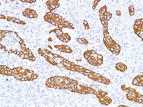 Immunohistochemistry (Formalin/PFA-fixed paraffin-embedded sections) - Anti-Cytokeratin 5 antibody [SP27] (AB64081)