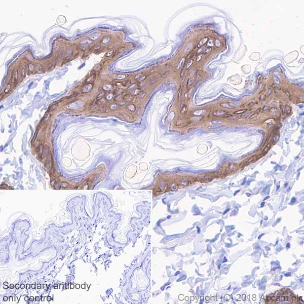 Immunohistochemistry (Formalin/PFA-fixed paraffin-embedded sections) - Anti-Cytokeratin 5 antibody [SP27] (AB64081)