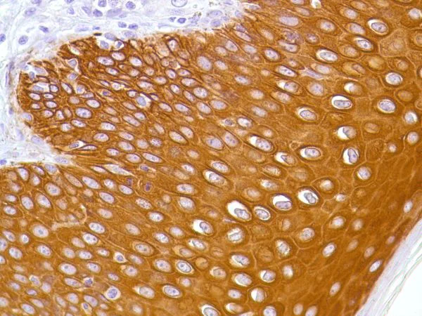 Immunohistochemistry (Formalin/PFA-fixed paraffin-embedded sections) - Anti-Cytokeratin 5 antibody [SP27] (AB64081)