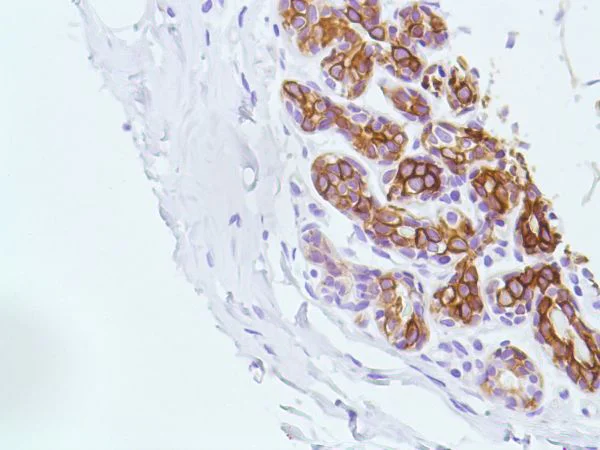 Immunohistochemistry (Formalin/PFA-fixed paraffin-embedded sections) - Anti-Cytokeratin 5 antibody [SP27] (AB64081)