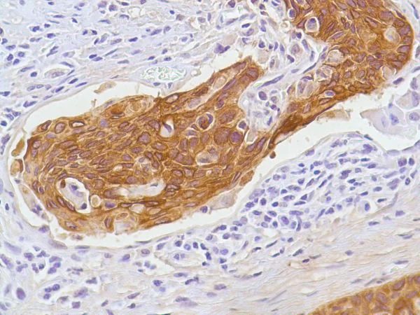 Immunohistochemistry (Formalin/PFA-fixed paraffin-embedded sections) - Anti-Cytokeratin 5 antibody [SP27] (AB64081)