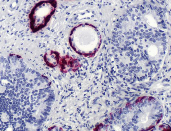 Immunohistochemistry (Formalin/PFA-fixed paraffin-embedded sections) - Anti-Cytokeratin 5 antibody [SP27] (AB64081)