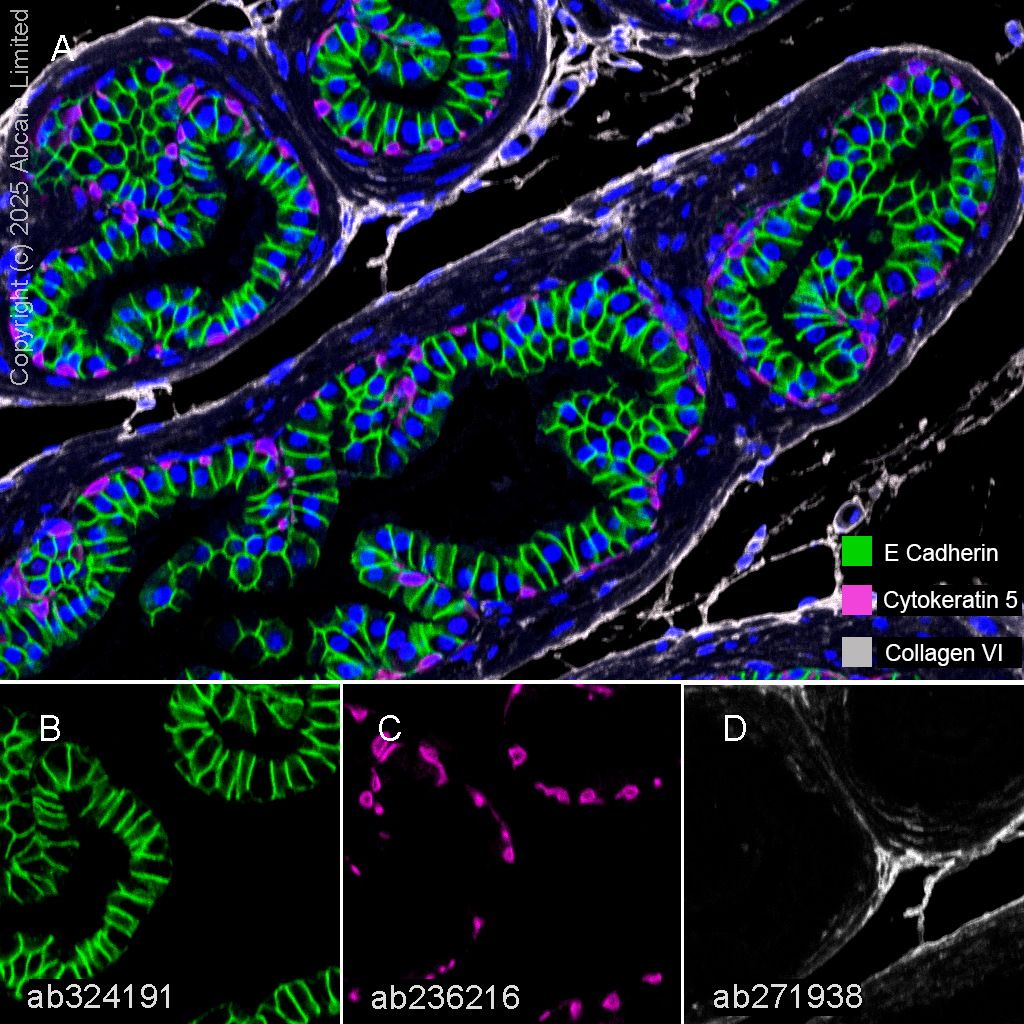 Anti-Cytokeratin 5 antibody [SP27] (ab64081) | Abcam