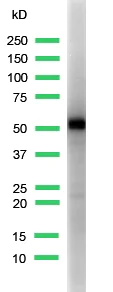 Western blot - Anti-Cytokeratin 5 antibody [SP27] (AB64081)