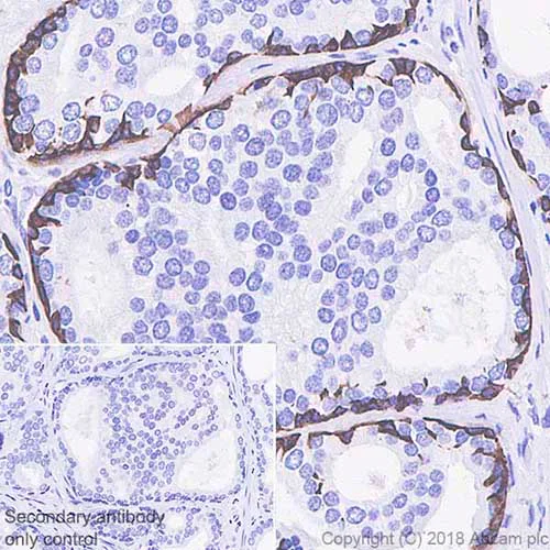 Immunohistochemistry (Formalin/PFA-fixed paraffin-embedded sections) - Anti-Cytokeratin 5 antibody [SP27] - BSA and Azide free (AB236216)