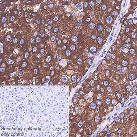 Immunohistochemistry (Formalin/PFA-fixed paraffin-embedded sections) - Anti-Cytokeratin 5 antibody [SP27] - BSA and Azide free (AB236216)
