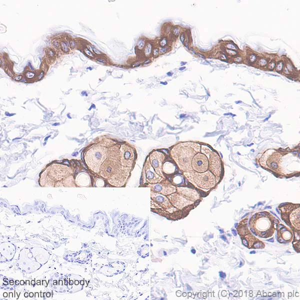 Immunohistochemistry (Formalin/PFA-fixed paraffin-embedded sections) - Anti-Cytokeratin 5 antibody [SP27] - BSA and Azide free (AB236216)