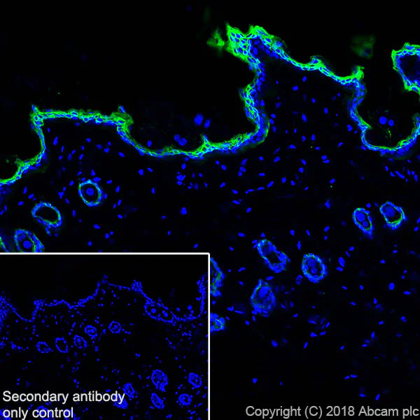 Immunohistochemistry (Frozen sections) - Anti-Cytokeratin 5 antibody [SP27] - BSA and Azide free (AB236216)