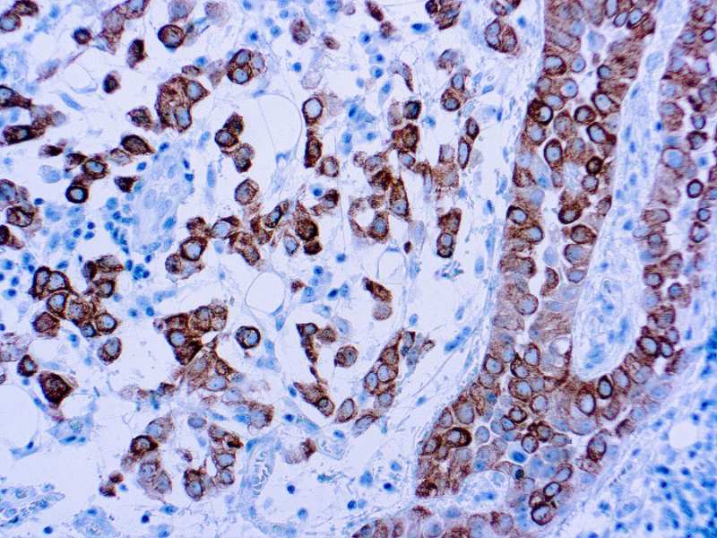 Immunohistochemistry (Formalin/PFA-fixed paraffin-embedded sections) - Anti-Cytokeratin 5 antibody [XM26] (AB17130)