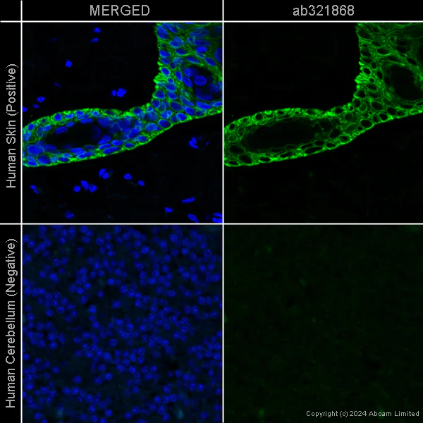Immunohistochemistry (Formalin/PFA-fixed paraffin-embedded sections) - Anti-Cytokeratin 5 - Cytoskeleton Marker [EP1601Y] – Goat IgG (Chimeric) (AB321868)