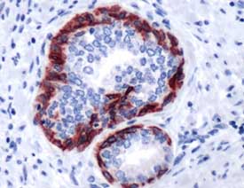 Immunohistochemistry (Formalin/PFA-fixed paraffin-embedded sections) - Anti-Cytokeratin 6 antibody (AB93962)
