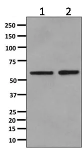 Western blot - Anti-Cytokeratin 6 antibody [EPR11517(B)] (AB166616)