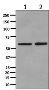 Western blot - Anti-Cytokeratin 6 antibody [EPR11517(B)] - BSA and Azide free (AB249355)
