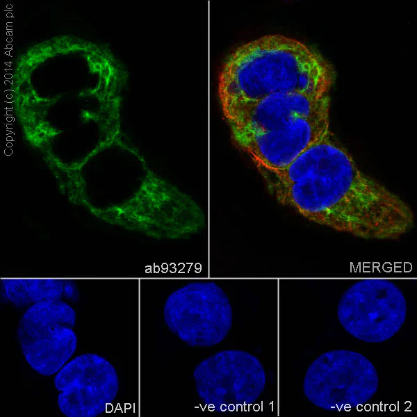 Immunocytochemistry/ Immunofluorescence - Anti-Cytokeratin 6 antibody [EPR1602Y] (AB93279)
