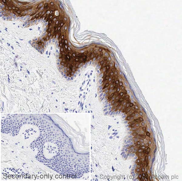 Immunohistochemistry (Formalin/PFA-fixed paraffin-embedded sections) - Anti-Cytokeratin 6 antibody [EPR1602Y] (AB93279)
