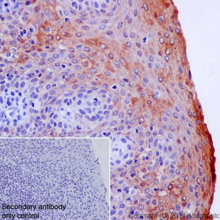 Immunohistochemistry (Formalin/PFA-fixed paraffin-embedded sections) - Anti-Cytokeratin 6 antibody [EPR1602Y] (AB93279)