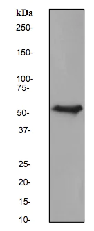 Western blot - Anti-Cytokeratin 6 antibody [EPR1602Y] (AB93279)
