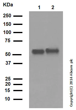 Western blot - Anti-Cytokeratin 6 antibody [EPR1602Y] (AB93279)