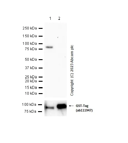 Western blot - Anti-Cytokeratin 6 antibody [EPR1602Y] (AB93279)