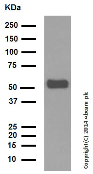 Western blot - Anti-Cytokeratin 6 antibody [EPR1602Y] (AB93279)