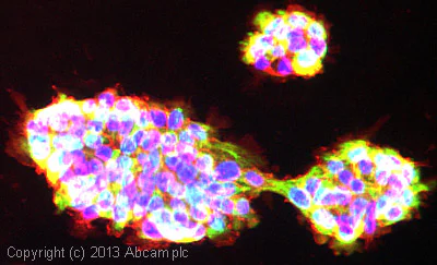 Immunocytochemistry/ Immunofluorescence - Anti-Cytokeratin 6 antibody [EPR1602Y] - BSA and Azide free (AB247600)