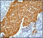 Immunohistochemistry (Formalin/PFA-fixed paraffin-embedded sections) - Anti-Cytokeratin 6 antibody [EPR1602Y] - BSA and Azide free (AB247600)