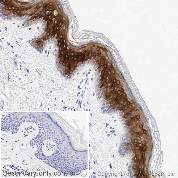 Immunohistochemistry (Formalin/PFA-fixed paraffin-embedded sections) - Anti-Cytokeratin 6 antibody [EPR1602Y] - BSA and Azide free (AB247600)