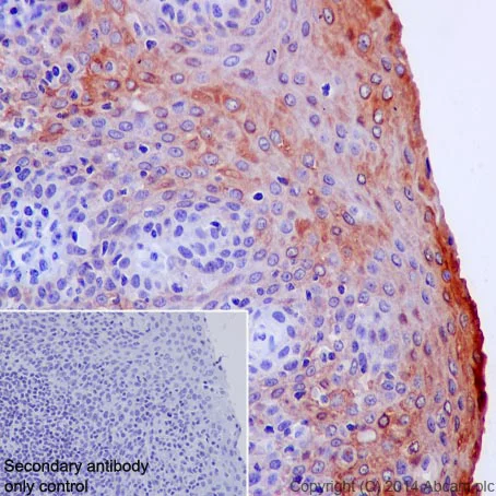 Immunohistochemistry (Formalin/PFA-fixed paraffin-embedded sections) - Anti-Cytokeratin 6 antibody [EPR1602Y] - BSA and Azide free (AB247600)