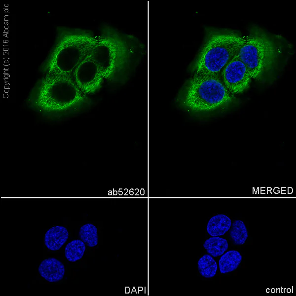 Immunocytochemistry/ Immunofluorescence - Anti-Cytokeratin 6 antibody [EPR1603Y] (AB52620)