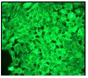 Immunocytochemistry/ Immunofluorescence - Anti-Cytokeratin 6 antibody [EPR1603Y] (AB52620)