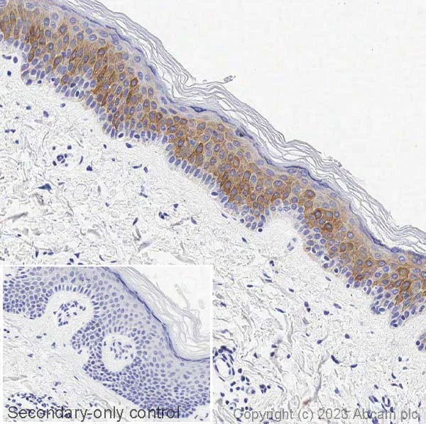 Immunohistochemistry (Formalin/PFA-fixed paraffin-embedded sections) - Anti-Cytokeratin 6 antibody [EPR1603Y] (AB52620)