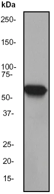 Western blot - Anti-Cytokeratin 6 antibody [EPR1603Y] (AB52620)