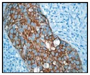 Immunohistochemistry (Formalin/PFA-fixed paraffin-embedded sections) - Anti-Cytokeratin 6 antibody [EPR1603Y] - BSA and Azide free (AB239845)