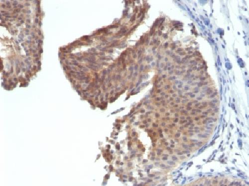 Immunohistochemistry (Formalin/PFA-fixed paraffin-embedded sections) - Anti-Cytokeratin 6 antibody [KRT6/1702] (AB218438), expandable thumbnail