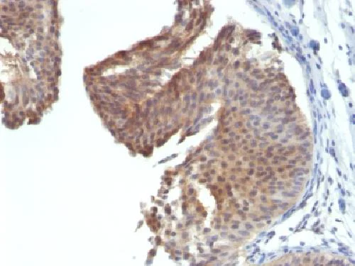 Immunohistochemistry (Formalin/PFA-fixed paraffin-embedded sections) - Anti-Cytokeratin 6 antibody [KRT6/1702] (AB218438)