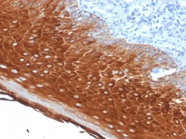 Immunohistochemistry (Formalin/PFA-fixed paraffin-embedded sections) - Anti-Cytokeratin 6 antibody [KRT6A/2368] - BSA and Azide free (AB237857)