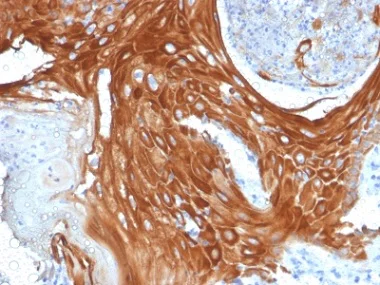 Immunohistochemistry (Formalin/PFA-fixed paraffin-embedded sections) - Anti-Cytokeratin 6 antibody [KRT6A/2368] - BSA and Azide free (AB237857)
