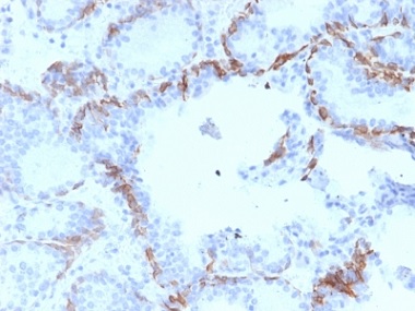 Immunohistochemistry (Formalin/PFA-fixed paraffin-embedded sections) - Anti-Cytokeratin 6 antibody [KRT6A/2368] - BSA and Azide free (AB237857)