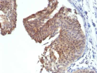 Immunohistochemistry (Formalin/PFA-fixed paraffin-embedded sections) - Anti-Cytokeratin 6a antibody [KRT6/1702] - BSA and Azide free (AB218899)