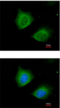 Immunocytochemistry/ Immunofluorescence - Anti-Cytokeratin 7 antibody (AB154334), expandable thumbnail