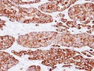 Immunohistochemistry (Formalin/PFA-fixed paraffin-embedded sections) - Anti-Cytokeratin 7 antibody (AB154334), expandable thumbnail