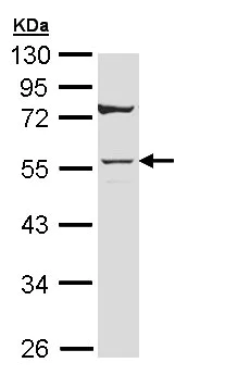 Western blot - Anti-Cytokeratin 7 antibody (AB154334)