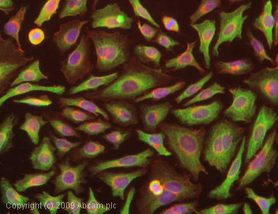 Immunocytochemistry/ Immunofluorescence - Anti-Cytokeratin 7 antibody (AB53123)
