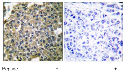 Immunohistochemistry (Formalin/PFA-fixed paraffin-embedded sections) - Anti-Cytokeratin 7 antibody (AB53123)